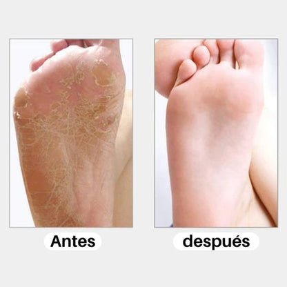 NanoSmooth™ - Recupera la suavidad de tus pies