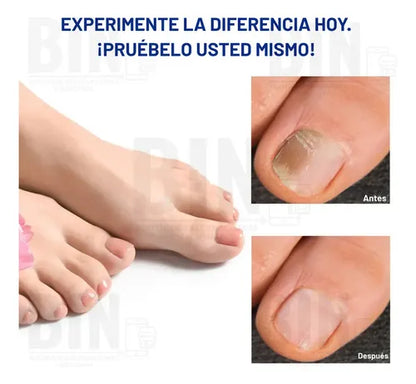 MycoShield™ - Tratamiento completo PACK Parche Anti Hongo (42unid)