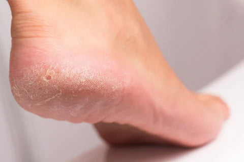 NanoSmooth™ - Recupera la suavidad de tus pies
